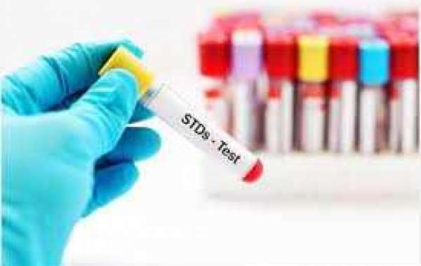 Sexually Transmitted Diseases Testing